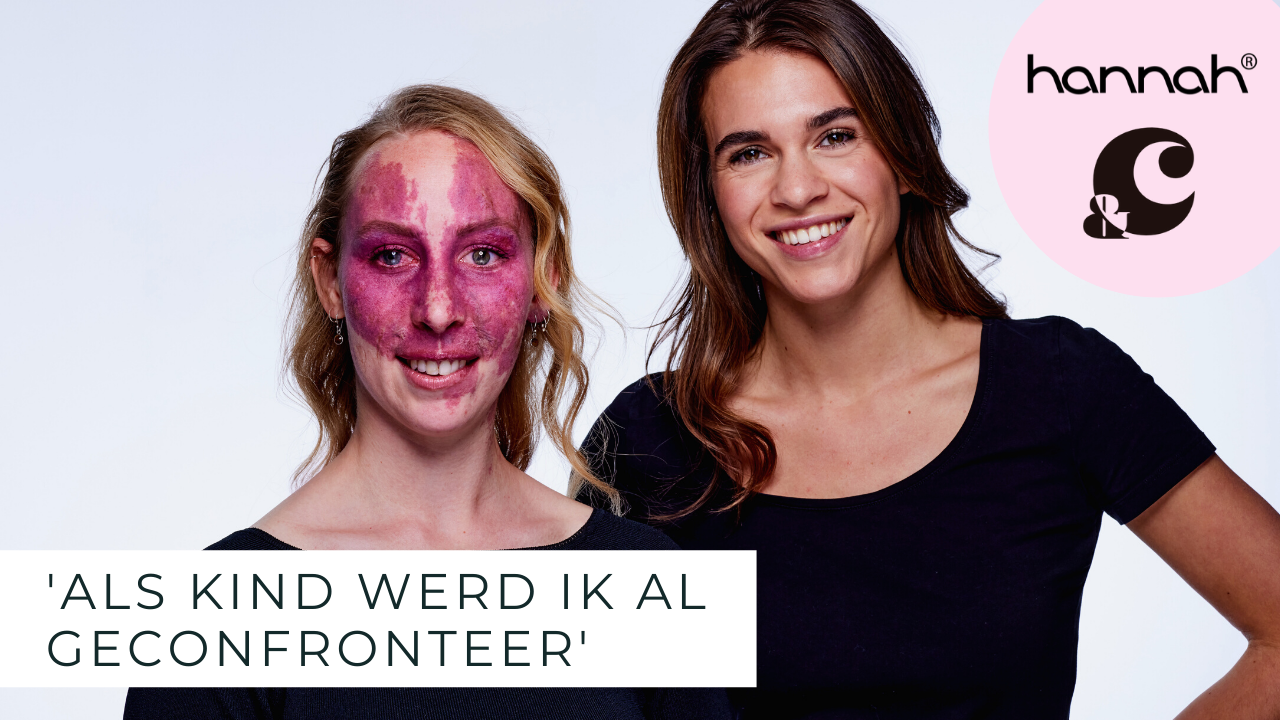 Julia Sinning_Chantal Janzen_echte schoonheid_perfecte imperfecties